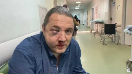 In The Center Of Moscow, Unidentified People Beat Ex-State Duma Deputy Maxim Shingarkin